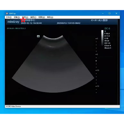 无线开关遥彩超胃镜阴道镜