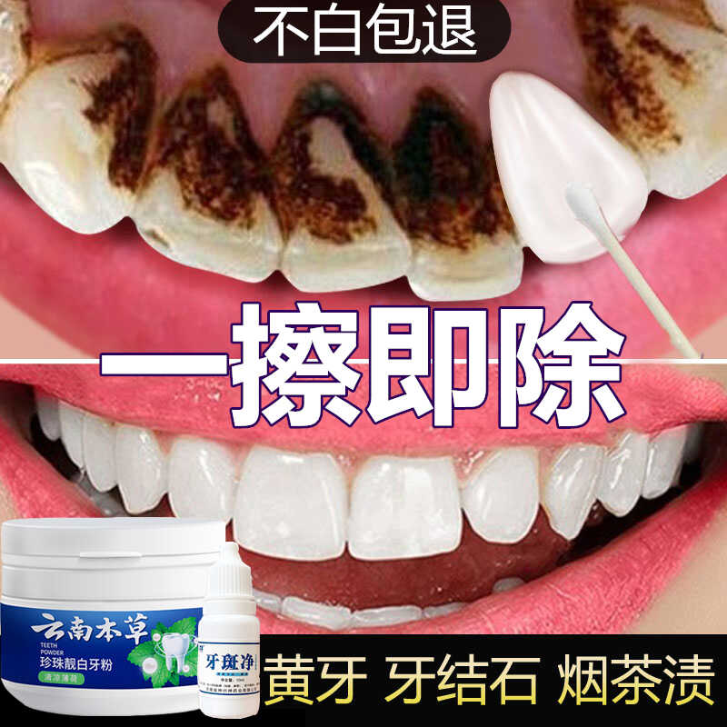洗牙粉去黄洗白速效齿污