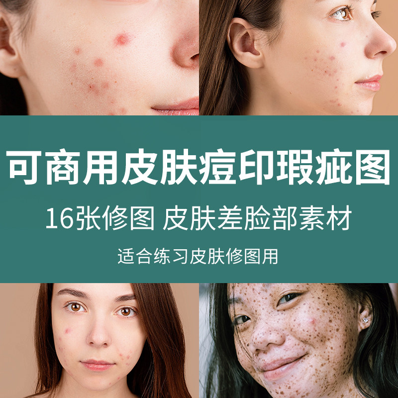 可商用皮肤痘印瑕疵图修图师美工ps后期皮肤脸部特写精修练习素材
