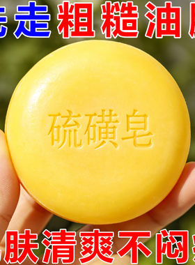 硫磺皂沐浴搓泥宝清洁深层