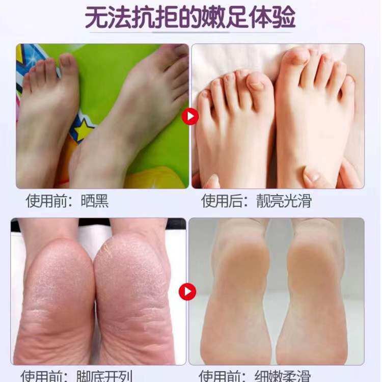 日本马油足膜去死皮老茧角质脚后足膜