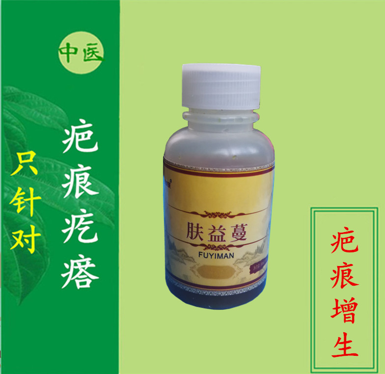 疤痕增生疤痕凸出疤痕疙瘩疤痕体质耳朵疙瘩耳朵疙瘩突起瘢痕疙瘩