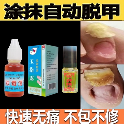 脱甲精油快速无痛不包不修脱甲油