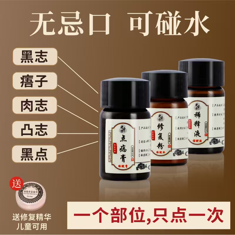 老古方点痣膏去黑痣凸痣不留痕