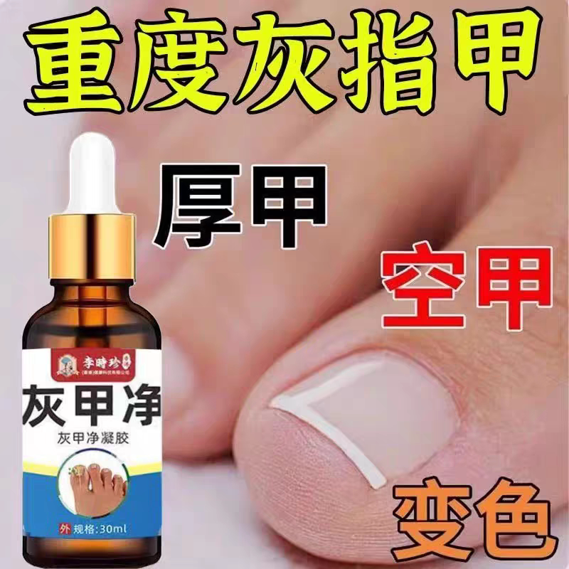 李时珍灰趾甲专用无痛去灰指甲严重甲沟炎指甲增厚亮甲快速