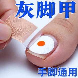 香港专研正品 灰指防护专杀真菌指板足部美甲店灰趾美甲净萃取植物