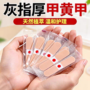 官方正品香港大药房灰指厚甲贴甲沟炎缓解贴指甲脚趾内卷矫正贴