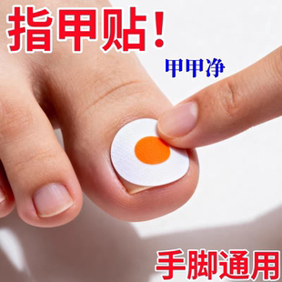 香港专研灰指防护专杀真菌指板足部美甲店灰趾美甲净萃取植物