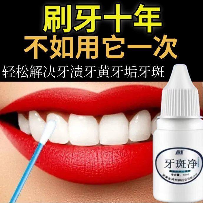 正品去牙渍神器烟渍去黄亮白牙齿牙斑净黄黑牙速效去除茶渍洗牙水