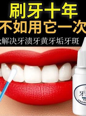 正品去牙渍神器烟渍去黄亮白牙齿牙斑净黄黑牙速效去除茶渍洗牙水