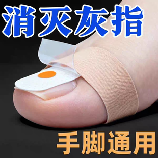 香港专研灰指防护专杀真菌指板足部美甲店灰趾美甲净萃取植物