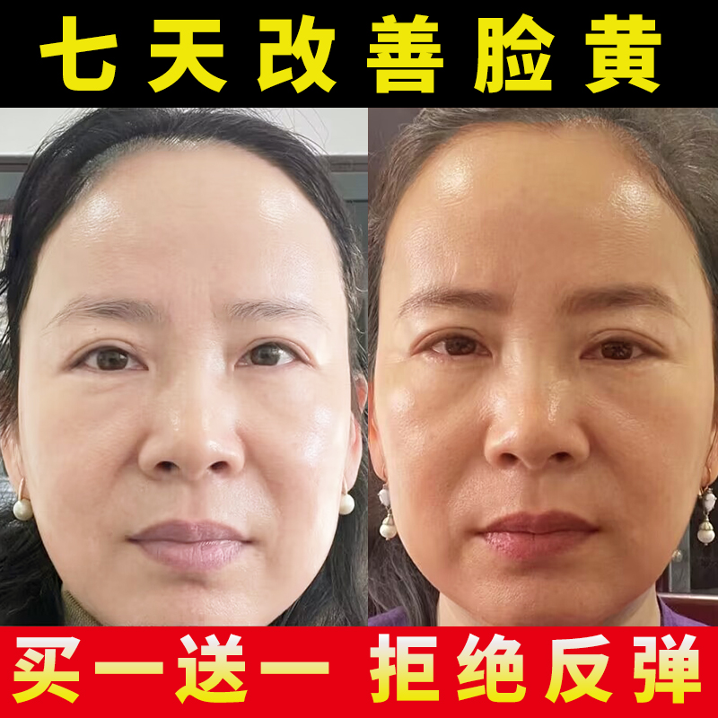【小红书推荐~帮助894836+人变白】美白皮肤发黄祛黄去斑精华液