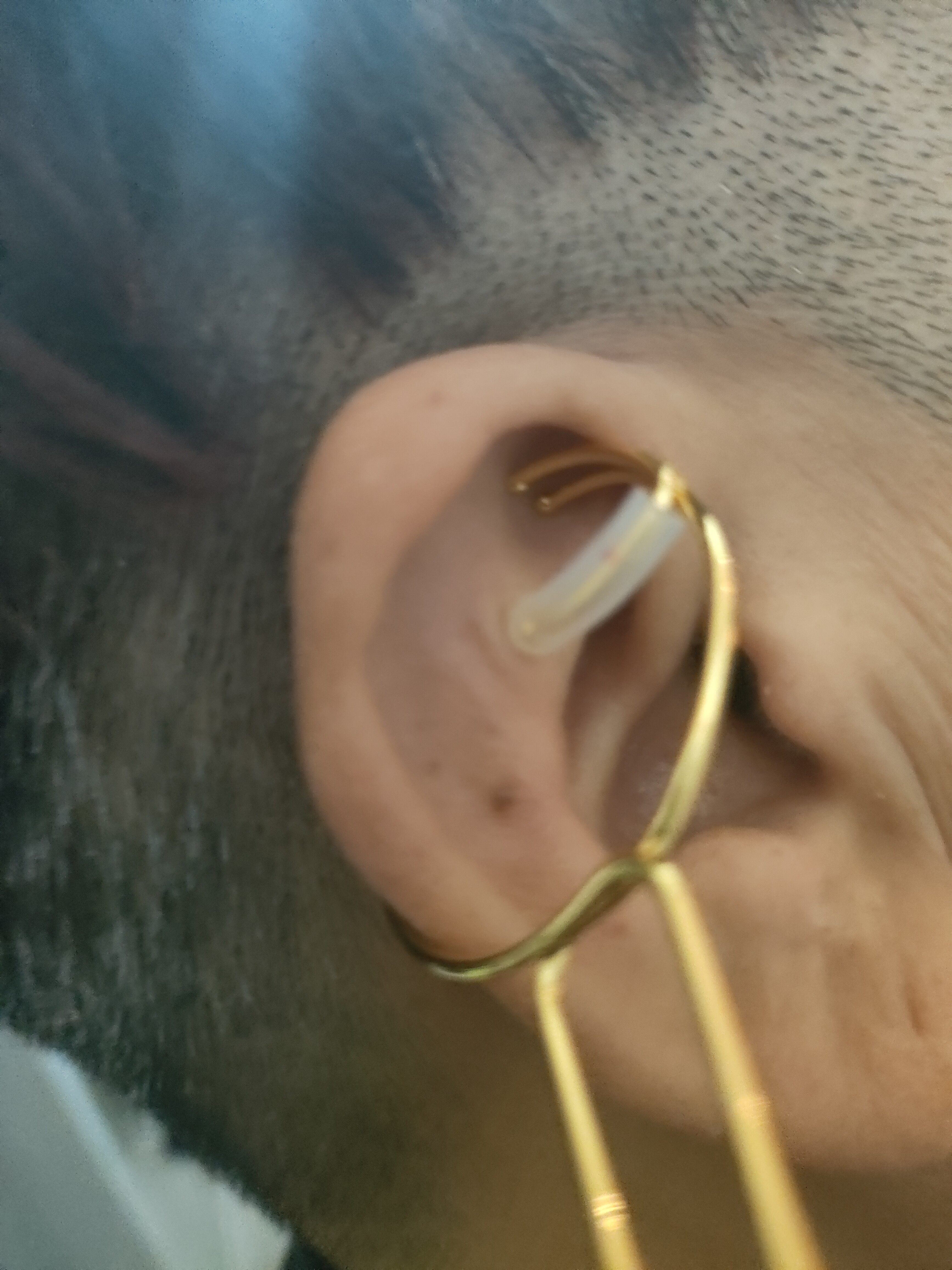 卡环点穴总部研发多功能镀金耳穴夹刺激点强度力度正好这样才管用