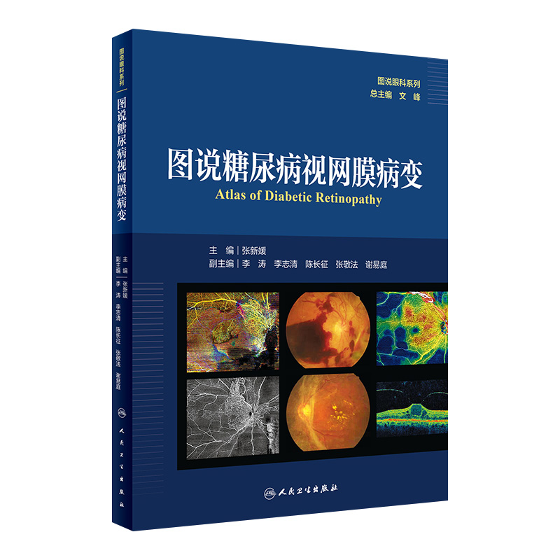 图说糖尿病视网膜病变图说眼科系列张新媛人民卫生出版社视网膜血管疾病青光眼白内障玻璃体视神经内分泌科OCT并发症眼科学影像