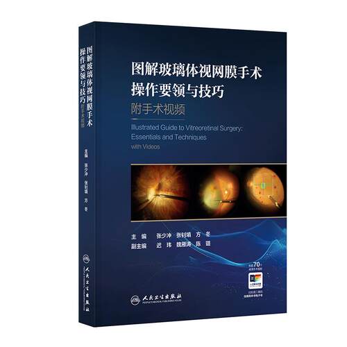 图解玻璃体视网膜手术操作要领与技巧附手术视频张少冲微创联合白内障手术眼科学人民卫生出版社医学专著