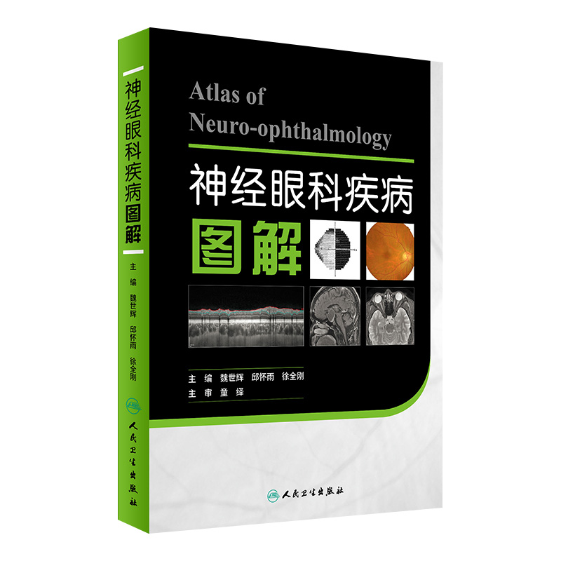神经眼科疾病图解 魏世辉 邱怀雨 徐全刚 主编 神经眼科疾病图谱治疗技术诊断学实用临床手术 人民卫生出版社 9787117243834