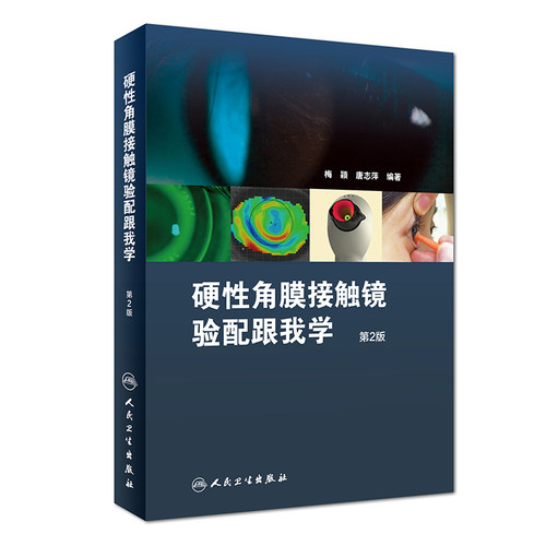 硬性角膜接触镜验配跟我学第二