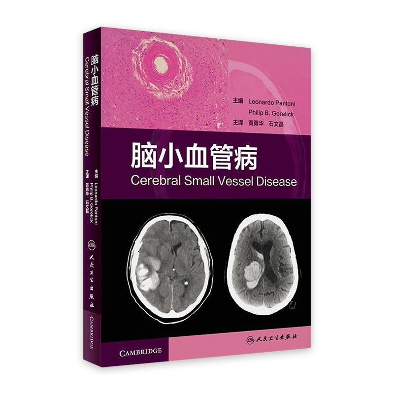脑小血管病 黄勇华石文磊主译内科学实用手册病理脑血管病9787117269964人民卫生出版社脑卒中神经影像学临床参考书脑小血管病学