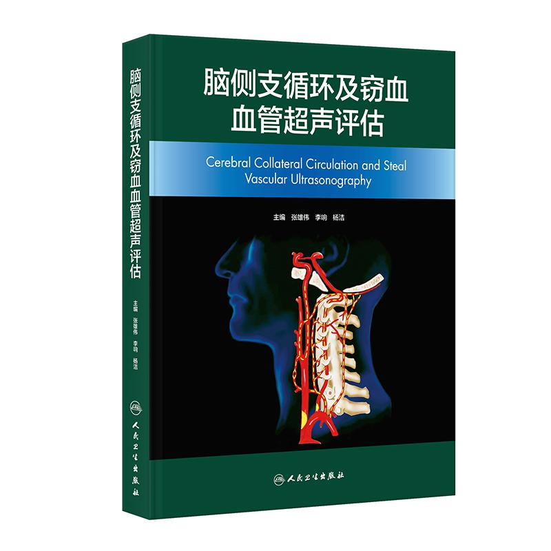 脑侧支循环及窃血血管超声评估 张宏伟杨洁李娟 临床脑卒中急诊内科外科神经介入急危重症人民卫生出版社影像医学神经病学