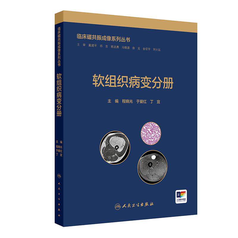 临床磁共振成像系列丛书——软组织病变分册 医学卫生/影像医学 程晓光,于爱红,丁宜 人民卫生出版社 9787117381109