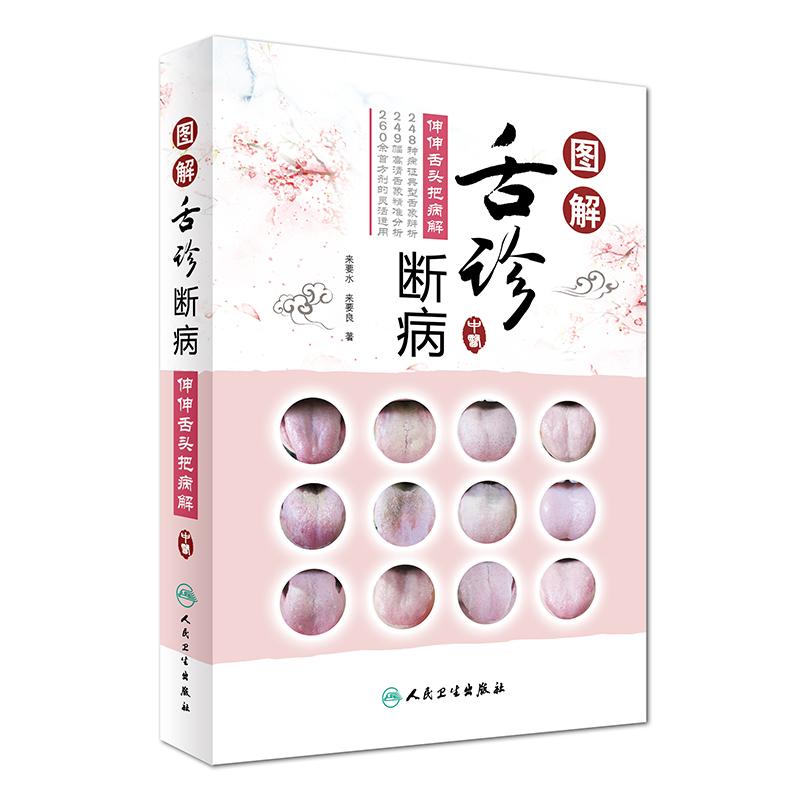 图解舌诊断病——伸伸舌头把病解