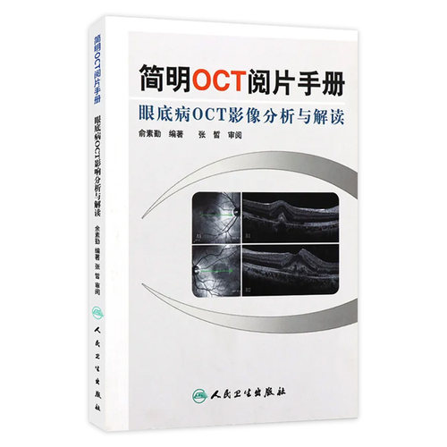 简明OCT阅片手册 眼底病眼科OCT影像分析与解读 俞素勤编著 基础阅片影像眼科学视光技术应用 人民卫生出版社9787117157551