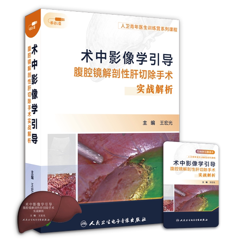 【优盘】术中影像学引导腹腔镜解剖性肝切除手术实战解析