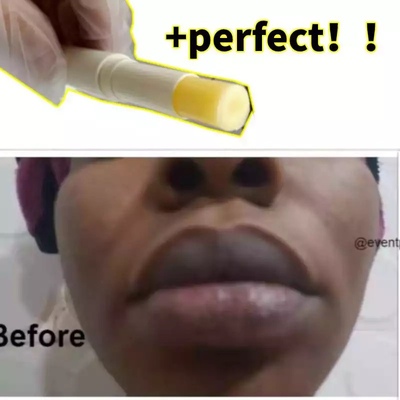 Natural Lip Balm Scrub For Lightening Dark Lips Men & Women