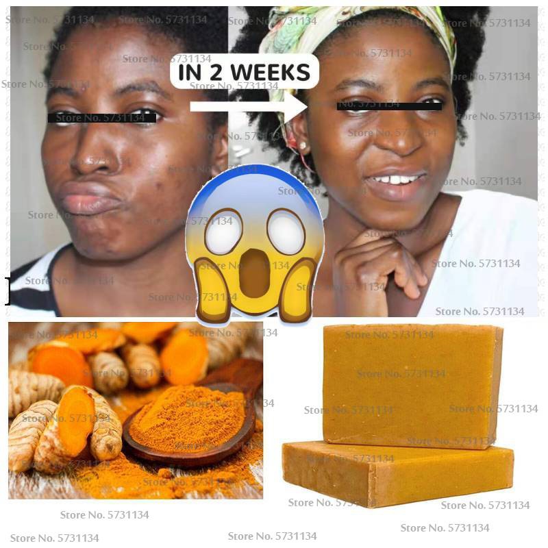 Tumeric Soap Natural Lightening Acne Dark Spots Brighter 美容护肤/美体/精油 手工皂/精油皂 原图主图