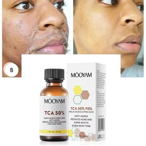 TCA 50% Chemical Peel Tca Peel Acid Skin Superforce Peel