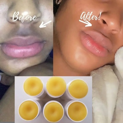 PINK LIPS FAST TURMERIC Honey Kojic Lemon Lip Balm Organic