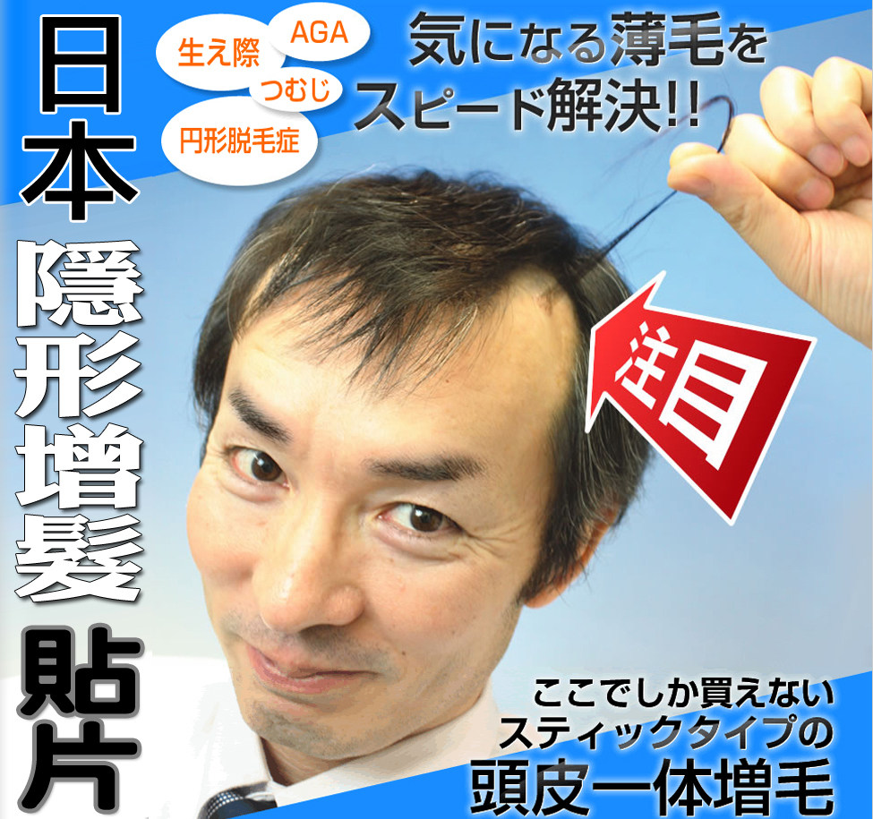 日本原装代购 quickpon隐形假发贴片 真人头发前额增发圆形发际线