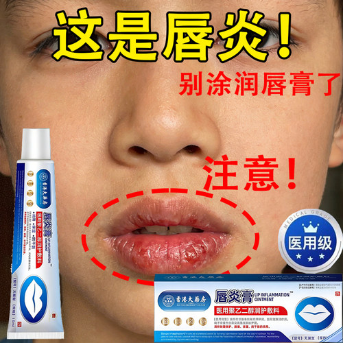 香港大药房医用儿童唇炎膏润唇嘴唇干裂脱皮宝宝专用保湿唇膏gn2