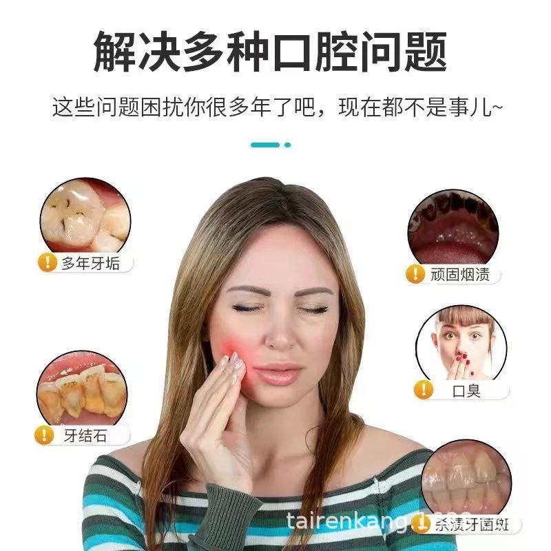 电动牙齿打磨机牙科修牙磨平器工具大人清洁牙结石抛光磨牙神器