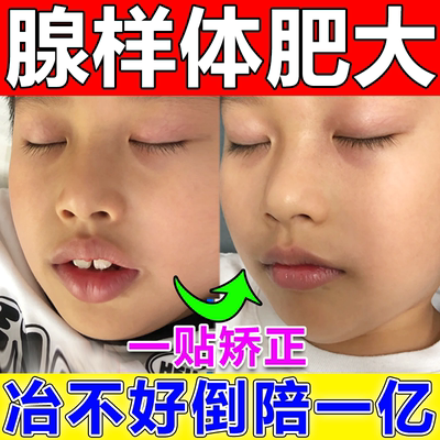 腺样体肥大面容矫正器调理儿童嘴唇上翘中药贴腺样体面容矫正克星