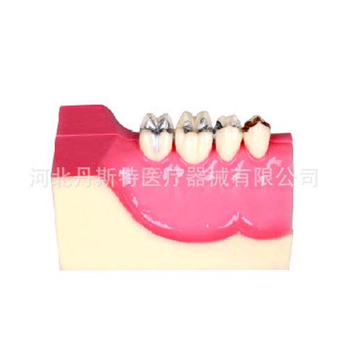 热销右下牙牙组织模型分解