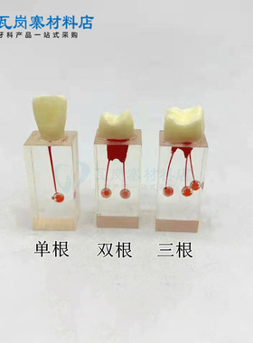 牙科材料 红色带球根管练习块  带牙冠扩大充填修复根管牙模型