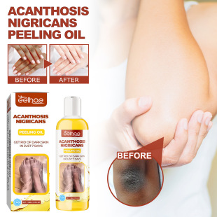 acanthus nigricans whitening brighten Exfoliating and oil