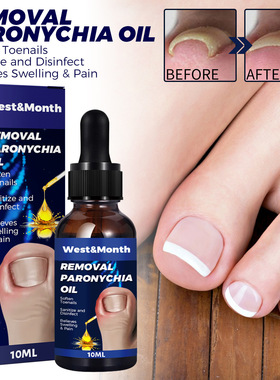 Nail repair oil hand and foot repair ingrown toenails soft a