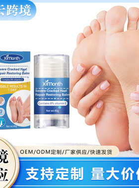 Heel repair cream prevents chapped heels from peeling repair
