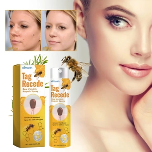 Bee Venom Wart Treatment Spray Improve Flesh Moles Repair Sm