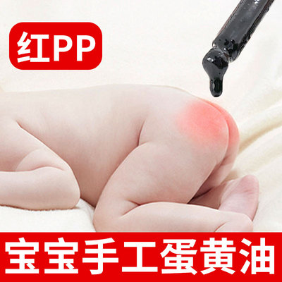 宝宝用蛋黄油拒绝红pp