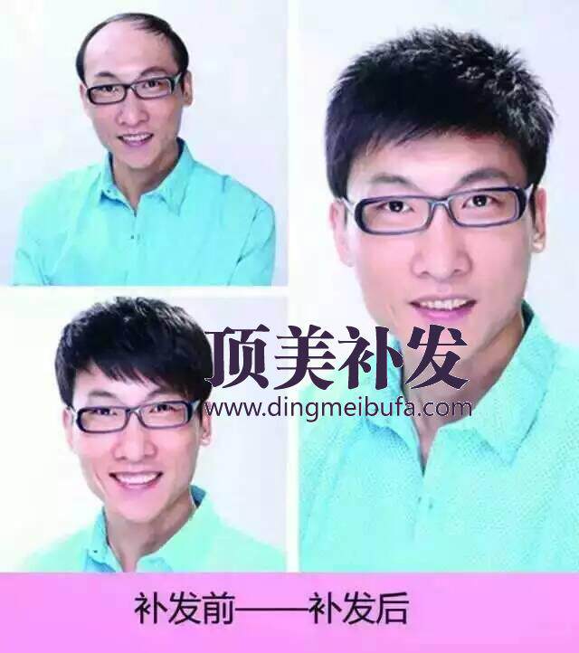 量身定制真人发青年 中年 老年直发片