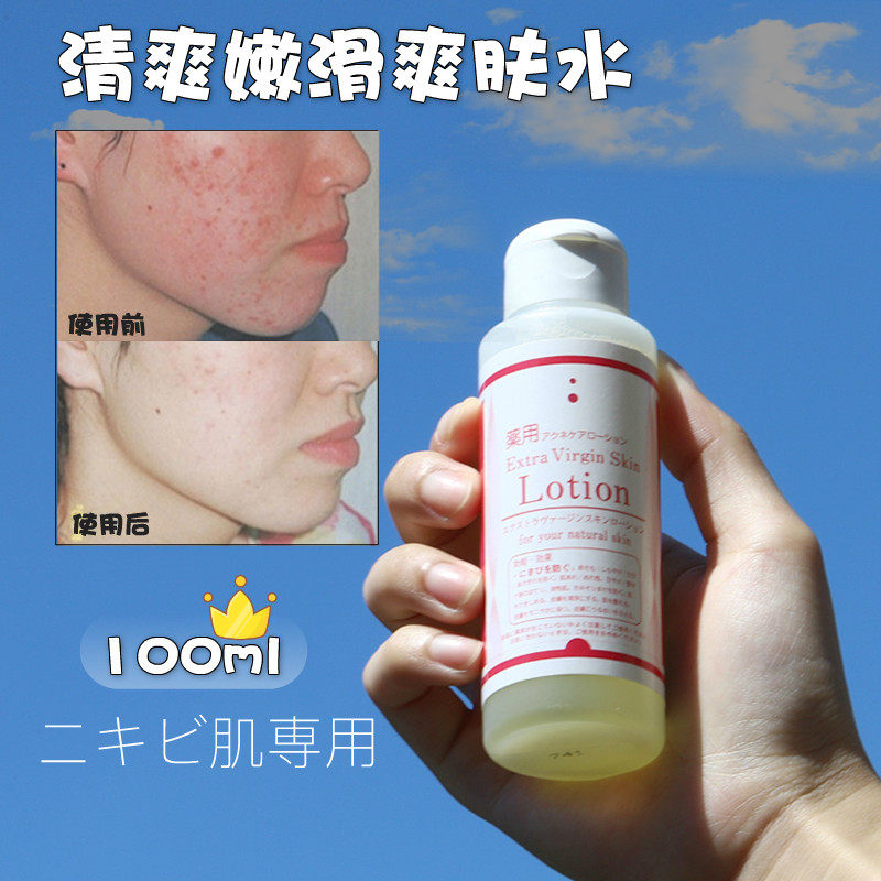 日本EXTRA  LOTION痘肌肤用痘粉刺闭合爽肤水化妆水肌肤变光滑