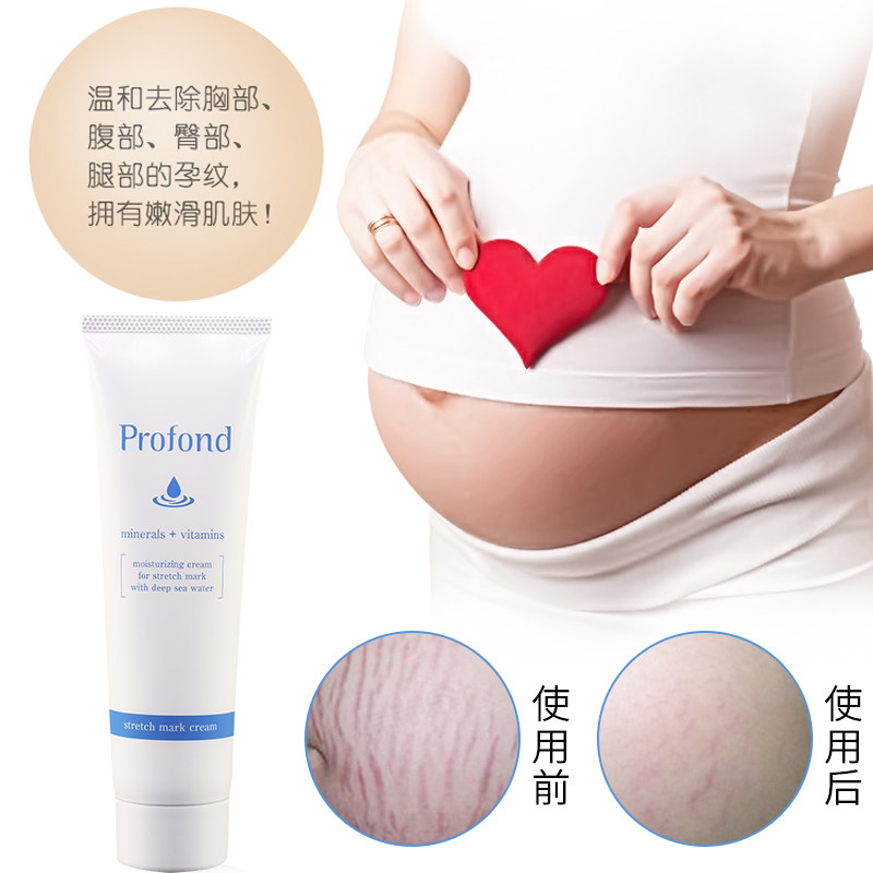 [日本myzxr777妊娠纹护理]日本Profond妊娠纹肥胖纹 孕妇月销量2件仅售130元