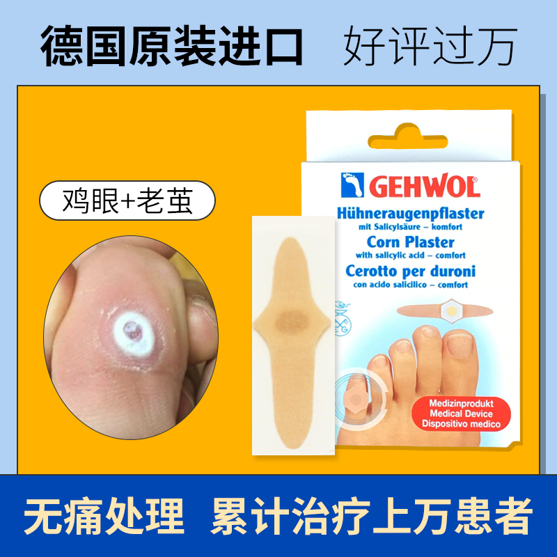 德國潔沃進(jìn)口正品雞眼貼去雞眼足部腳底雞眼膏神器去根無痛