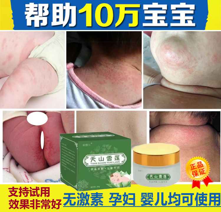 【买1送1发2盒】一抹灵儿童装正品皮肤止痒湿痒宝宝孕妇小孩儿童