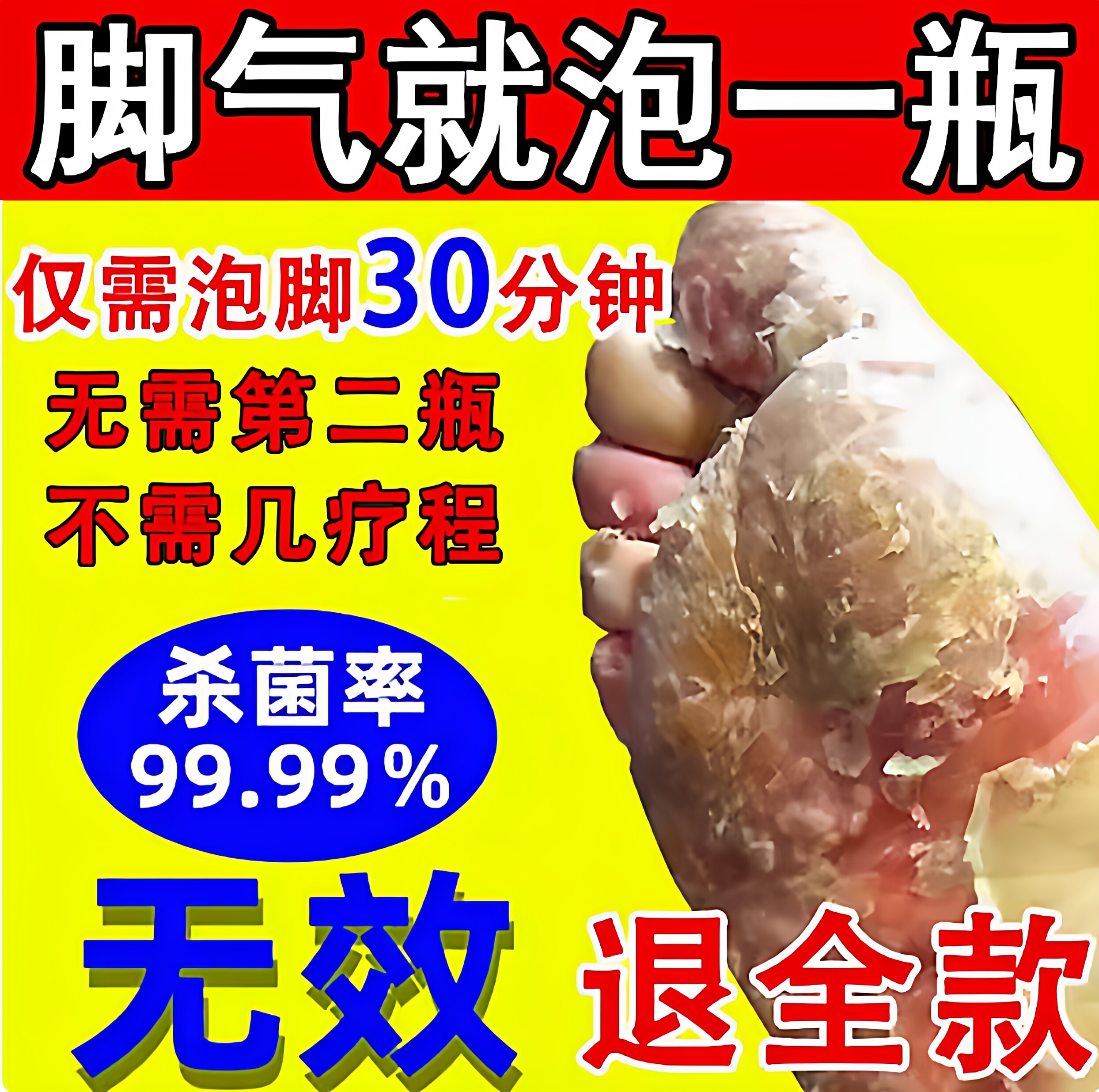 脚气止痒脱皮杀菌泡脚药包去水泡皮肤消毒护理（消）