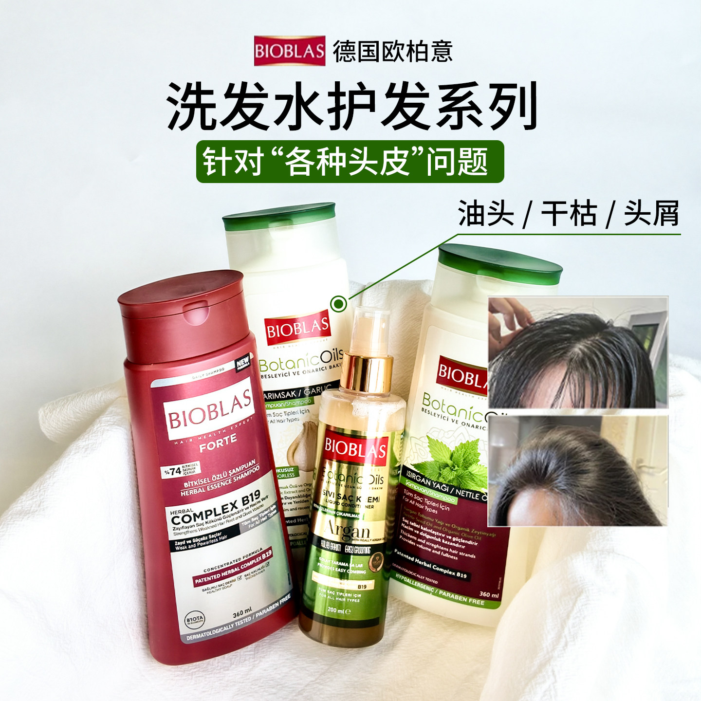 欧柏意大蒜去屑控油防脂溢洗发水