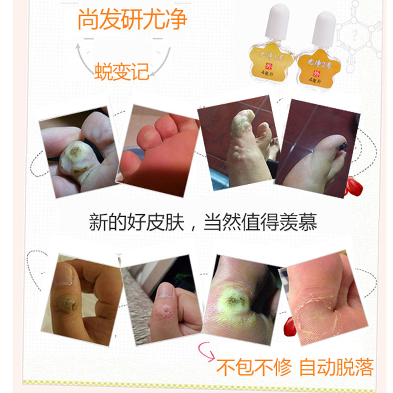 尚发研尤净套装 131一盒 一次性买两盒送一盒